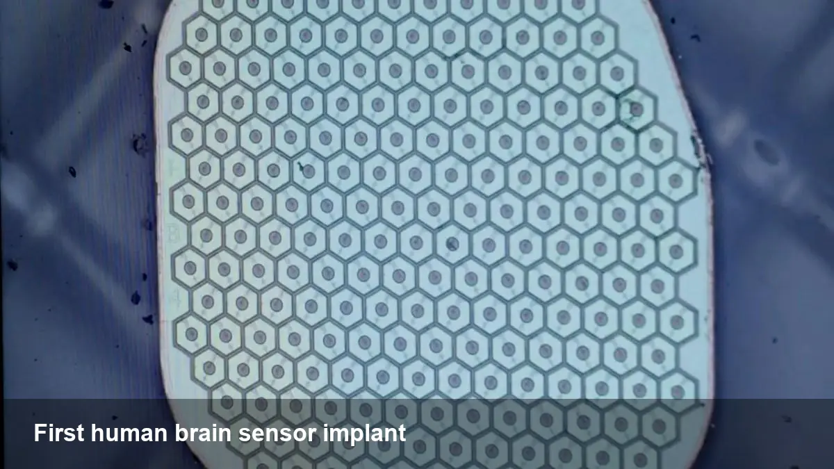 Science Corp's First Human Brain Sensor