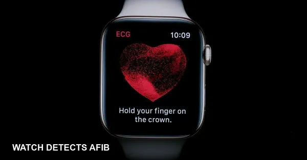 Study: Apple Watch detects AFib 4x more