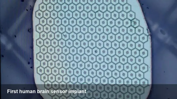 Science Corp's First Human Brain Sensor